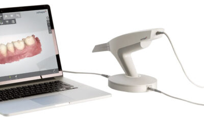 Abdruckfreie Behandlung mit 3Shape