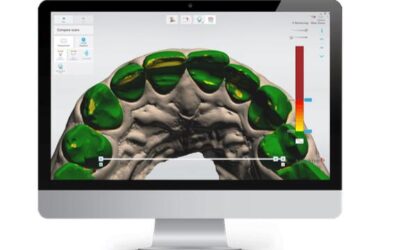 Monitoring – wir überwachen Ihre Zahn- und Mundgesundheit